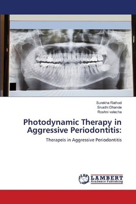 Photodynamic Therapy in Aggressive Periodontitis by Surekha Rathod Paperback Boo