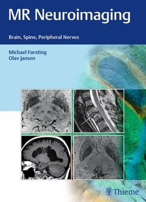 MR Neuroimaging: Brain, Spine, Peripheral Nerves by Michael Forsting: New