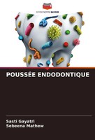 Sasti Gayatri (U. A.) | PoussÉE Endodontique | Taschenbuch | FranzöSisch (2024)