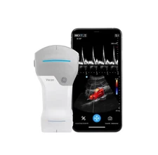 GE Vscan Air CL Portable Ultrasound