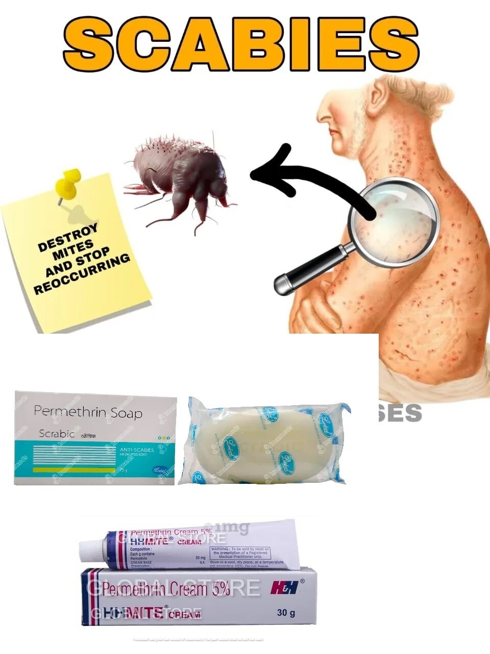 OINTMENT SOAP ANTI SCABIES KILLS SCABIES MITES & EGGS COMPLETE