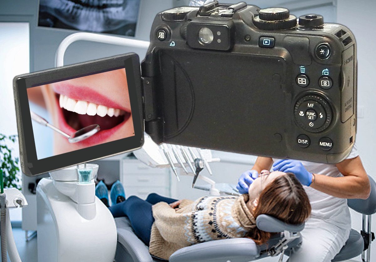 DENTAL CAMERA CANON G12 Digital Set Up For Intraoral Orthodontic