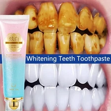 Niacinamide Whitening Toothpaste,Natural Niacinamide Toothpaste,Teeth Whitening