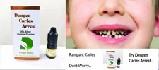 DenGen Dental Caries Arrest For Dental Care, 5 ML / 0.17 OZ - Free Ship