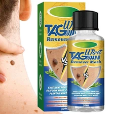 Wart Remover Flüssigkeit Plantar Genital Warzen behandeln Haut Tags Entfernung 