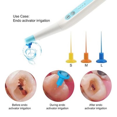 Endo Activator Sonic Irrigator Dentistry Root Canal Cleaning Device + 60 Tips