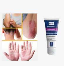 Crema Para Dermatitis Eczema Psoriasis Para Comezon Picazon Ronchas En La Piel