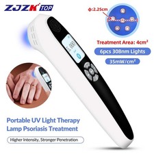 308nm UVB Lamp Localized Phototherapy for Face Hand Foot Skin Disorders 35mW/cm 
