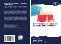 Vinnie Sharma (U. A.) | Jesteticheskie Koronki W Detskoj Stomatologii | Buch