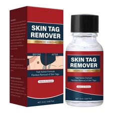 Fast-Acting Wart Remover with Maximum Strength Salicylic Acid, Effectively Remov