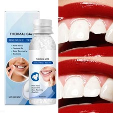 Teeth Glue For Loose Teeth Tooth Repair Beads Dental Fixing Kit Temporary New
