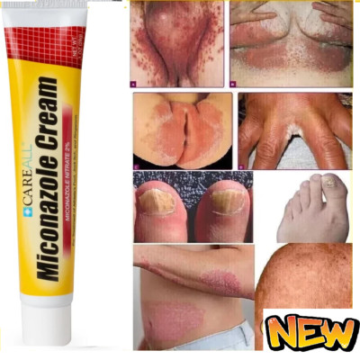 Crema Pomada para Los Hongos En La Piel Pies Brazos Genitales Manos Cara Eficaz