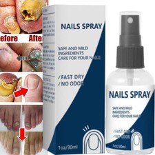 Blinzador Nails Spray Fingernails Nutrition Long-Lasting Toenail Care Supplies