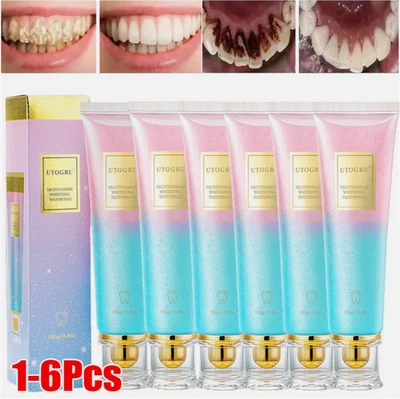 UTOGRU Niacinamide Intensive Whitening Toothpaste, Remove Tooth Stains, Fresh Breath UK