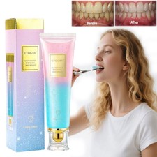 Niacinamide Whitening Toothpaste,Natural Niacinamide Toothpaste,Teeth Whitening