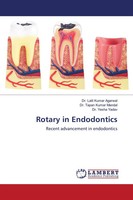 Lalit Kumar Agarwal (U. A.) | Rotary In Endodontics | Taschenbuch | Englisch