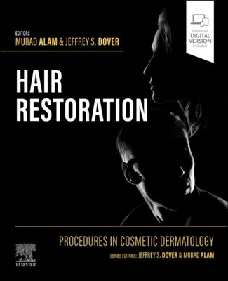 Procedures in Cosmetic Dermatology Hair Restoration by Murad Alam HARDBACK