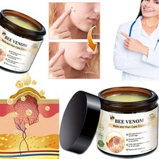 Bee Venom Skin Tag Removal Treatment Cream Body Care Mole Corn Wart Remover 60g