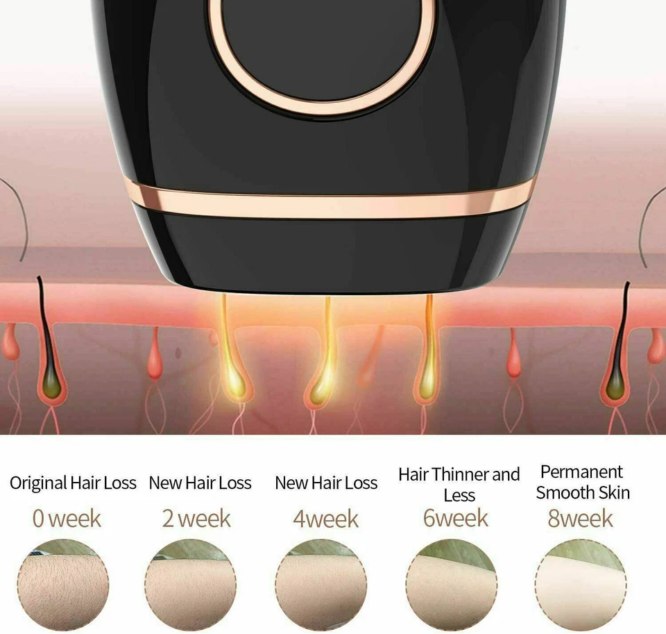 IPL Laser Haarentfernungsgerät für Männer und Frauen 999999 Lichtimpulse - Bild 4 von 4