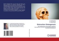 Distraction Osteogenesis Vishakha Bhindi