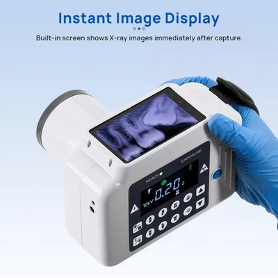 LCD Screen Dental Portable X High Frequency Unit +Digital S e n s o r Size 2
