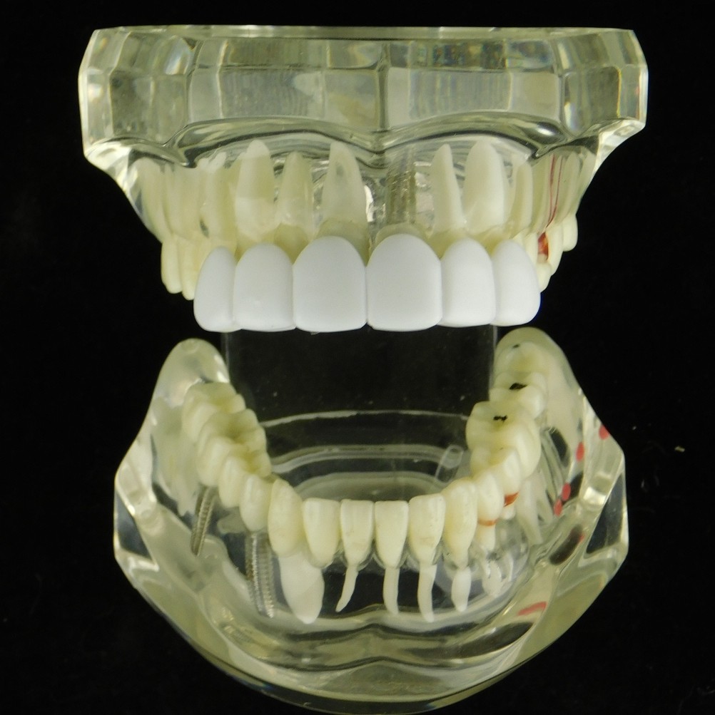 Men's White Teeth Grillz Top 6 Teeth Bright Smile Pre-Made Instant Mouth Grills