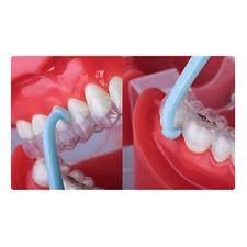 J&J Ortho Dental Ortodontyczny nastawnik Remover Haczyk Retriever (10/pak)