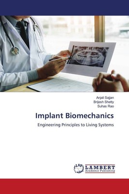 Implant Biomechanics | Engineering Principles to Living Systems | Sajjan (u. a.)