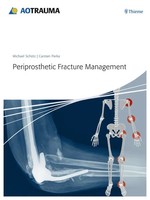 Periprosthetic Fracture Management | Michael SchüTz (U. A.) | Englisch | Buch
