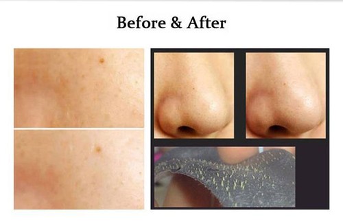 Korean Charcoal Nose Pore Cleansing Strips Blackhead Peel Off mask pack_40pcs - Picture 3 of 4
