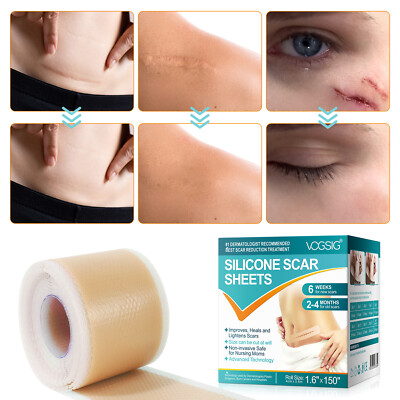 Surgical Dressing Silicone Gel Sheet For Non-Chronic Wound Care - China - Foto 2