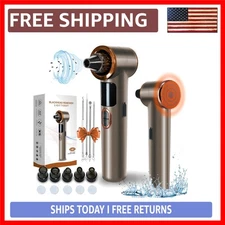 Luxury Blackhead Remover Vacuum with Heating Technology – Deep Pore Cleaning ...