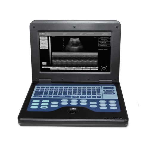 CONTEC Tragbarer Ultraschallscanner Laptop Maschine 6,5 MHz Transvaginalsonde - Bild 2 von 12