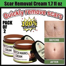Scar Acne Removal Stretch Marks Old Scars Burns Repair Cream 1.7 fl oz. Pack 2