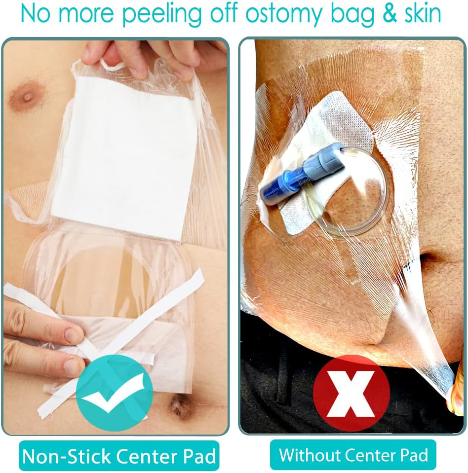 25 Pcs Waterproof Stoma Shower Cover 9x9, Ostomy Bag Protector Shield