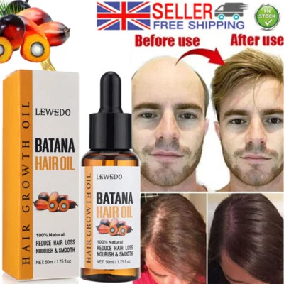 LEWEDO 50ml Natural Batana Oil For Hair Growth Healthier Thicker Fuller Anti Hair Loss