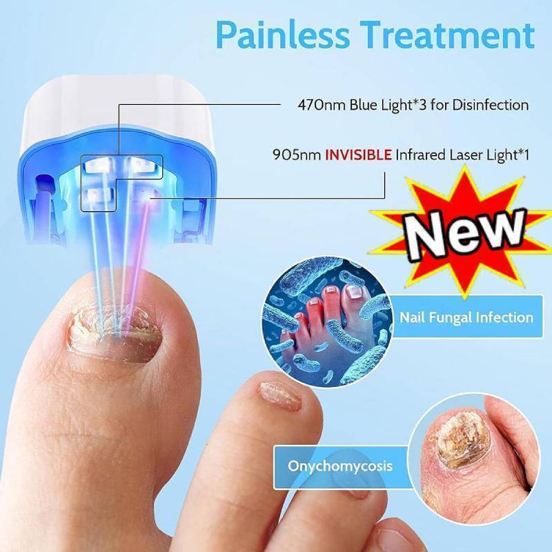 Nail Fungus Laser Device, Anti Fungal Treatment Laser Devices for Onychomycosis eBay
