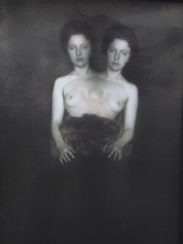 VINTAGE - NEGATIVE - Siamese twins - CIRCUS SHOW - HORROR - FREAK