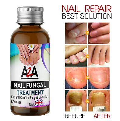 10ml Fungal Nail Treatment Highly Effective Kill Nail Fungus For Best Result Uk Ebay