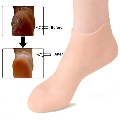 2 Pair Full Length Silicone Gel Moisturizing Socks Foot Care Protector Free Ship - 第 1/15 張圖片