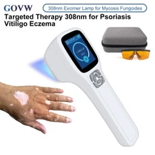 Medical 49pcs Diodes Excimer 308nm Light Treatment for skin disease