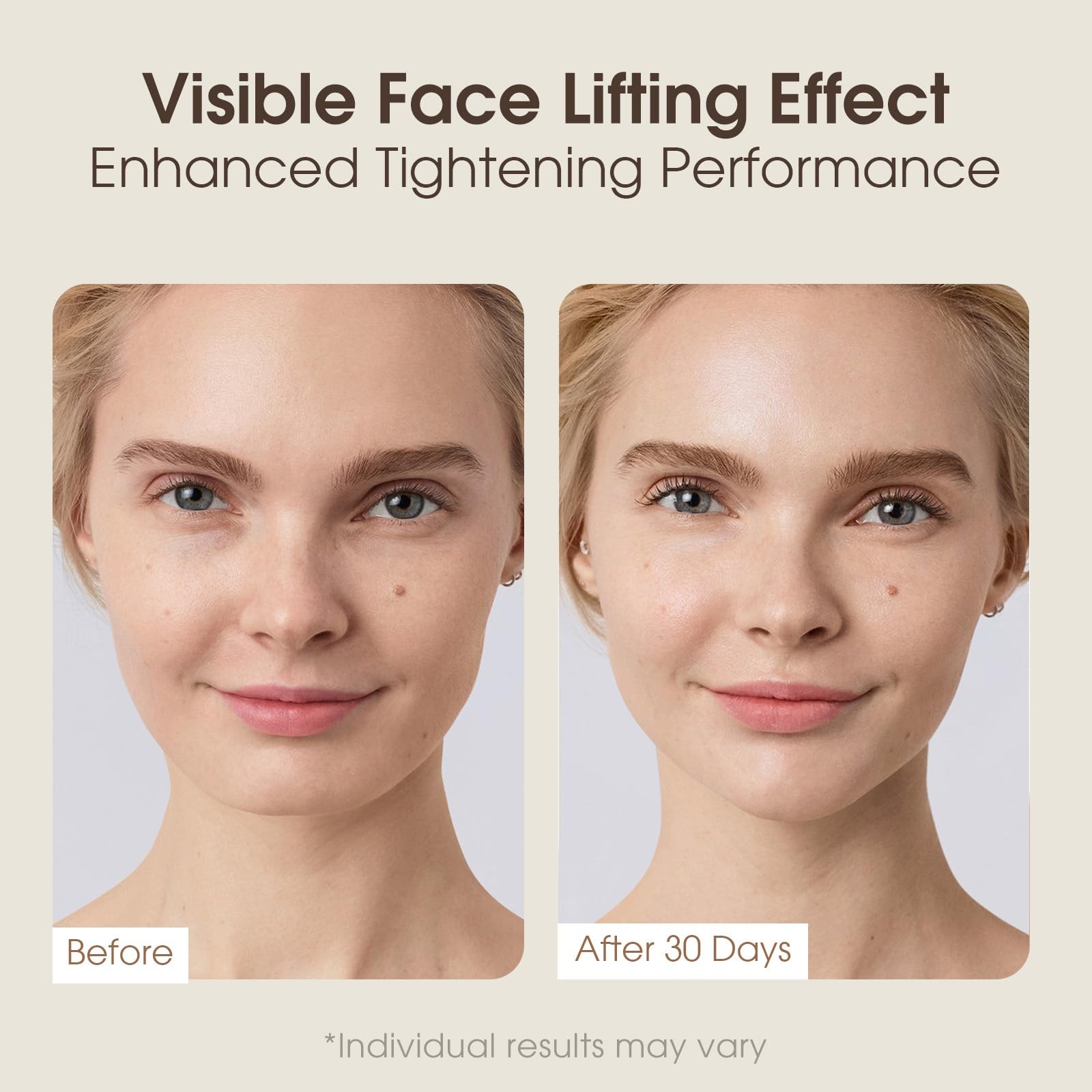 Intelligent Double Chin Reducer and V-Face Lift Belt Machine with Remote Cont...