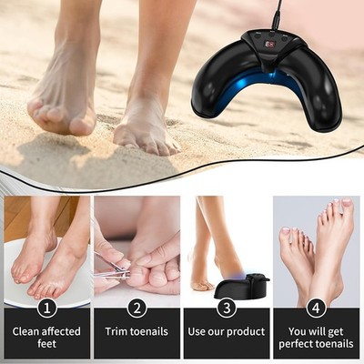 Lightweight Flexible High-Performance Nail Fungus Laser Therapy Device Care Tool