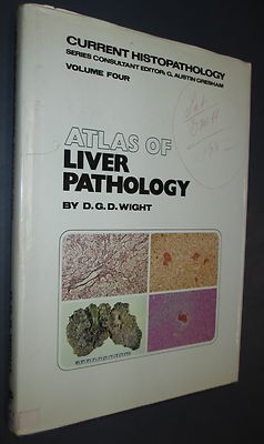 Atlas of Liver Pathology 0-397-50-453-5 Hardcover Medical Text Book 1982