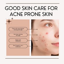 FREE SHIPPING - Rosacea Calm: The Benefits of Black Soap