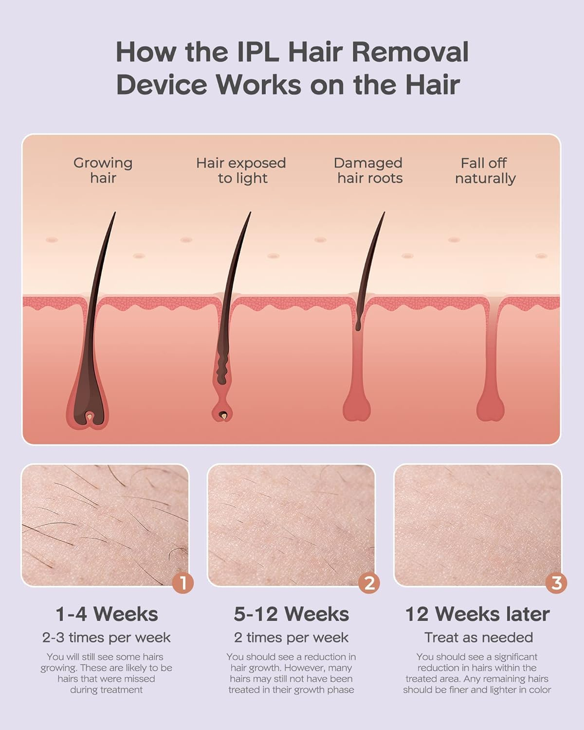 INNZA Laser Hair Removal Device for Women and Men at Home, IPL Hair