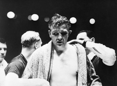 Boxer Walter Neuscl a swollen face a badly damaged left eye after - 1935 Photo