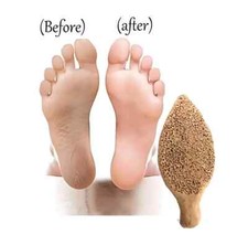 2x Natural Clay Terracotta Foot Scrubber Rasp Dead Skin Calus Remover Stone Care