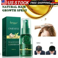 Ginger Hair Growth Spray For Men Women Natural Ginger Serum Hair Loss Treatment
