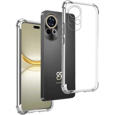 Case For Huawei Nova 12 5G - Nova 13 5G - Cover TPU Silicone Anti